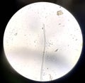 Close up parasite in stool exam.