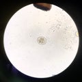 Close up parasite in stool exam.
