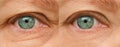 Close up part of face mature woman 55 years old, human eye, lower, upper eyelid, deep wrinkles around eyes, age-related skin