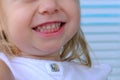 Close-up part of the face of a small child, a blonde girl 2 years old in white blouse smiles, shows molars, concept of childhood,
