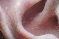 Close-up of part of the male ear in soft focus with strong magnification under the microscope Royalty Free Stock Photo