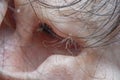 Close-up of part of the male ear in soft focus with strong magnification Royalty Free Stock Photo