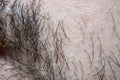 A close-up of a part of male skin with partially shaved facial hair