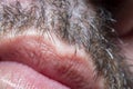 A close-up of a part of male skin with partially shaved vegetation on the face and lips with a strong magnification under a micros