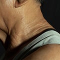 A close up on parts of neck and shoulder of an elderly asian person