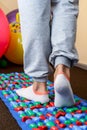 Close-up of the patient`s legs walking on carpet in a rehabilitation room. yoga mat