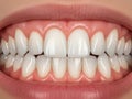 Close-up of a perfect smile Royalty Free Stock Photo
