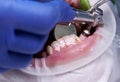 Doctor cleaning and polishing patient teeth in dental clinic.