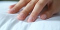 Close-up of perspiration on a woman hand grabbed a piece of sheet on the bed , concept of Hygiene