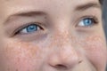 Close-up photo. Body part. Young happy and joyful face in freckles, blue eyes of a child, teenager, looking away Royalty Free Stock Photo