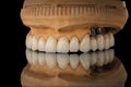 Close-up photo of a dental upper jaw prosthesis on black glass background. Artificial jaw with veneers and crowns. Tooth