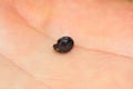 Close-up photo of a dry tick on human hand