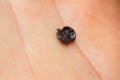 Close-up photo of a dry tick on human hand