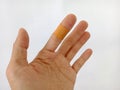 Close-up photo of an injured hand covered in band aid, a picture taken in a studio Royalty Free Stock Photo