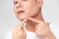 Close up photo of young man looking for acnes on his face Royalty Free Stock Photo