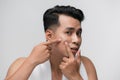 Close up photo of young man looking for acnes on his face Royalty Free Stock Photo