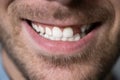 Man With Missing Tooth Royalty Free Stock Photo