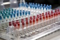 close-up of pipettes and test tubes in a laboratory