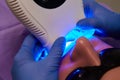 Close-up portrait of a female patient at dentist in the clinic. Tooth filling ultraviolet lamp. Shallow dof.