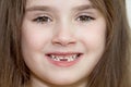 The close up portrait of little girl`s face with missing front lower milk teeth in a smiling mouth Royalty Free Stock Photo