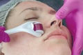 Close-up portrait of woman processing skin in beauty salon. Doctor prepares skin using a mesoscooter
