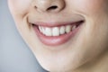 Close up portrait of Young Asian girl teeth smiling Royalty Free Stock Photo