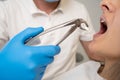 Close-up of the process of removing a tooth from the oral cavity. The doctor holds the forceps with the extracted