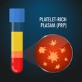 Close-up of PRP platelets in a test tube Royalty Free Stock Photo