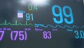 Close up of pulse and oxygen rate showings displayed on a medical screen