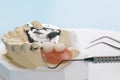 Removable partial denture RPD. Royalty Free Stock Photo