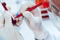 Close up. scientist puts a mark on the tube with the test.