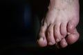 Close up of shamed woman hiding her altlete`s foot fungus infection