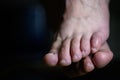 Close up of shamed woman hiding her altlete`s foot fungus infection