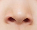 Baby nose