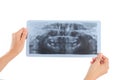 Hands Holding Dental X-Ray Of A Child Royalty Free Stock Photo