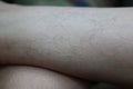 Close-up of skin, hair, legs, white skin of Asian women. Medical