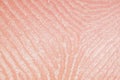 Close-up skin with sebaceous secretions on human leg, macro Royalty Free Stock Photo