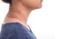 Close up skin of woman neck showing different color from sun UV