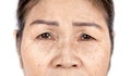 Close up skin wrinkle and freckles of old asian woman face Royalty Free Stock Photo