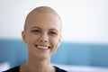 Smiling young hairless woman suffer from oncology