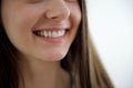 Young woman with beautiful smile, closeup. Teeth whitening Close-up of a smiling woman in a transparent plastic Royalty Free Stock Photo