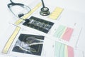 stethoscope  Put on a bone Density hip and spine report.too soft and blurry image Royalty Free Stock Photo
