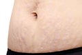 Close up stretch marks Royalty Free Stock Photo