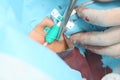 Close-up of the surgeon working