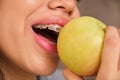 Close up of teenager mouth with braces eating an apple. Royalty Free Stock Photo