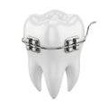 Close-up of a Human Tooth with Metal Braces and Archwire on White Background Royalty Free Stock Photo