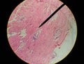 Close up Tissue parasit Trichinella spiralis.
