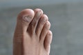 close up toes of asian adults, at grey background