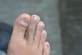 close up toes of asian adults, at grey background