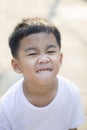 Close up tooth and kidding face of asian children standing outdoor Royalty Free Stock Photo